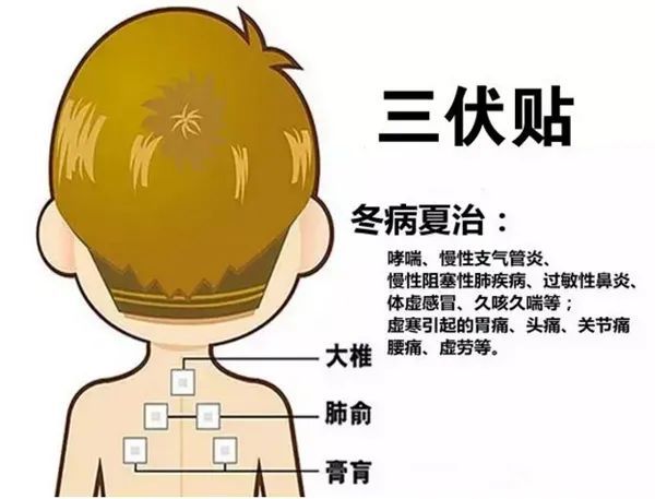 2、三伏貼的功能和功效是什么？