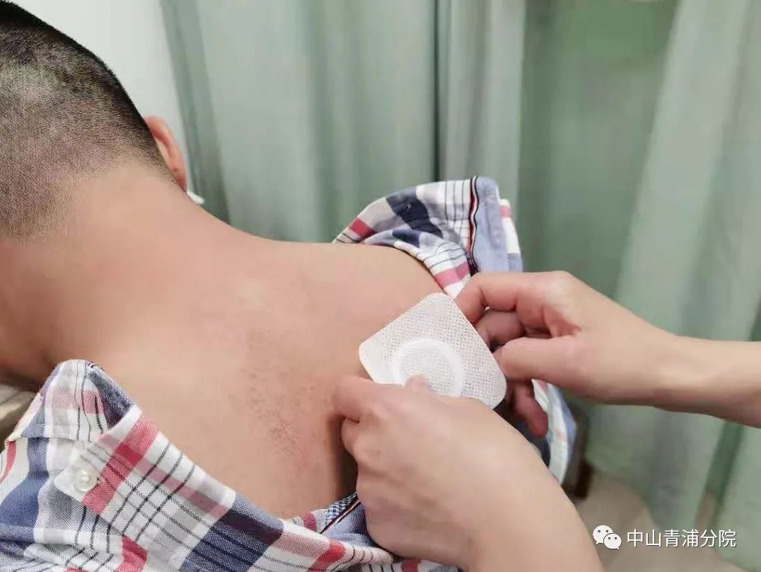 2、江西兒童貼三伏貼癢灼痛，什么體質(zhì)的人可以貼三伏貼癢灼痛？