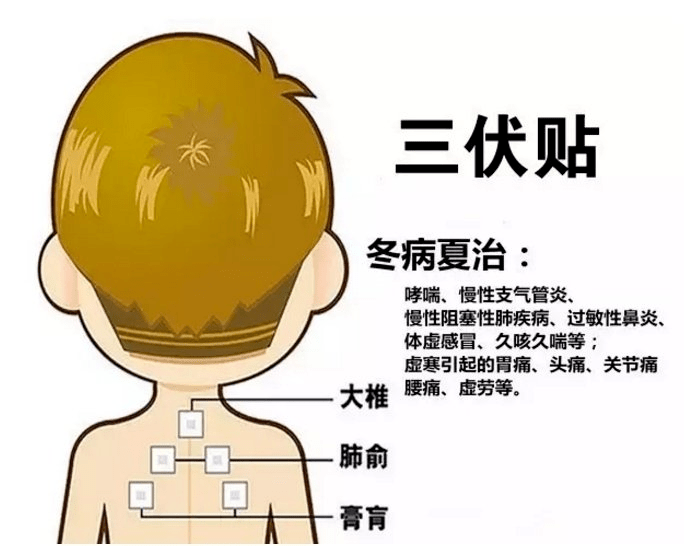 1、三伏貼多大？寶寶能貼多少？</p><p>三伏貼孩子貼多久？